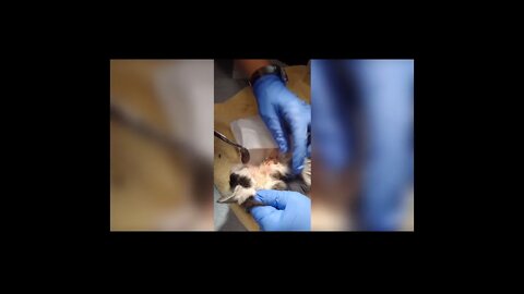 Popping huge blackheads and Pimple Popping Best Pimple Popping Videos Episode 1