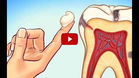 The Tooth Decay Process: How to Reverse It and Avoid a Cavity