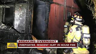 Man seriously burned, firefighter transported to the hospital after house fire in Venice