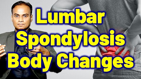 Changes in the Body due to Lumbar Spondylosis | Low Back Pain Effects, Homeopathy Treatment & Cure