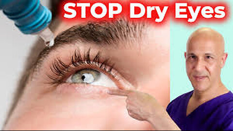 Soothe and Heal DRY EYES Naturally! Dr. Mandell