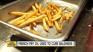 McDonald's french fries may be cure for baldness, according to new study