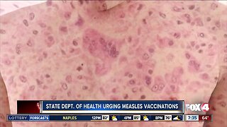 Two measles cases reported in Florida