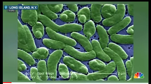 Rare flesh-eating bacteria found in person who died in New York