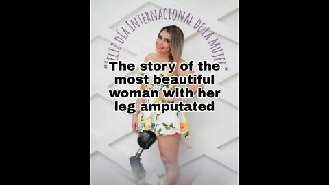 The story of the most beautiful woman with one of her legs amputated