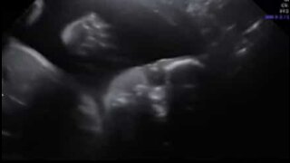 超音波検査でカメラに向かって手を振る赤ちゃん