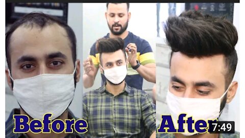 Hair Patches For Men | Hair Transformation | Hair Wig For Men | Natural hair line front lace patch..