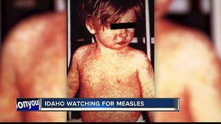 Washington measles outbreak is causing concern among Idaho health officials