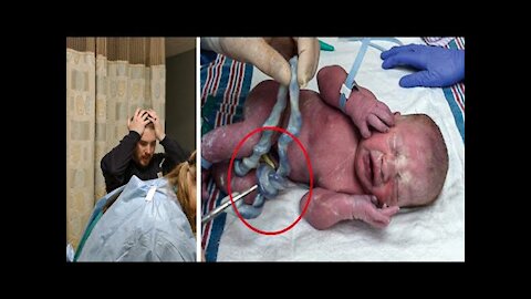 Doctor Delivers Healthy Baby, Then Sees The Umbilical Cord And Realizes It’s A Miracle.