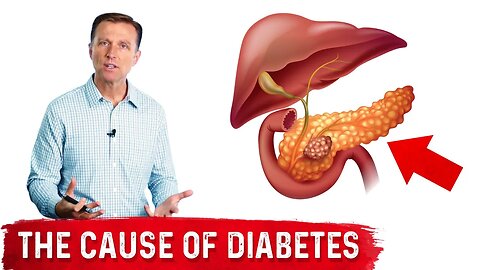 Your Fatty Pancreas Caused Your Diabetes