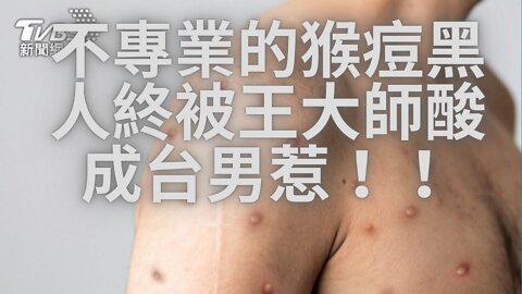 🔴猴痘侵台！照片終換台男、PHEIC與FAKE、快篩EUA、幼兒拼最晚7月、上海宣布防疫成功、美商會與北市停電、要省電從台積電開始、台灣民政府吸金洗錢、美墮胎權、6月FED依然沒縮表