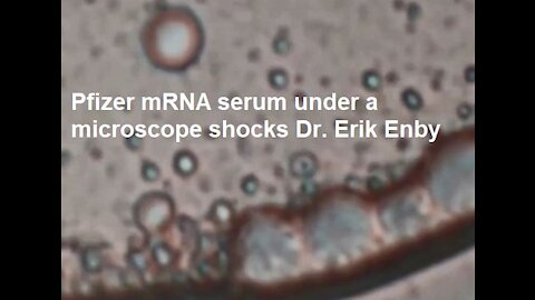 Dr. Erik Enby - Pfizer mRNA Serum Under A Microscope Reveals Shocking Living Organisms