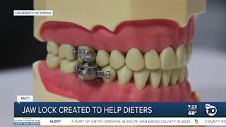 Weight loss device stops users from opening mouth too wide?