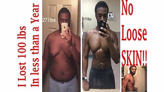 Safely lose 100 lbs in less than a year with NO Loose SKIN