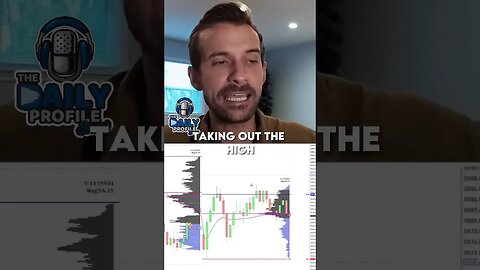 Korbs: Mastering Day Trading - 14 Points in a Single Day!