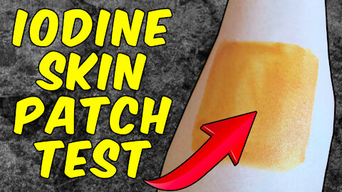 How to Perform the Iodine Patch Test