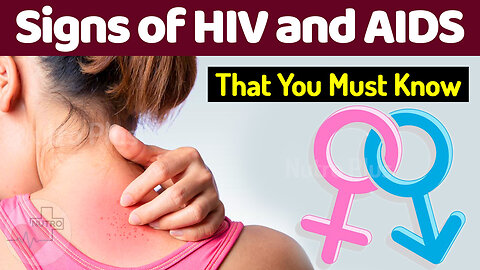 Sign and Symptoms of HIV and AIDS that You Must Know