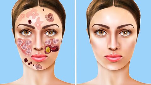 ASMR Face Treatment Animation | 2D Animation Video | Relaxing Video | @BeautyASMRSecrets