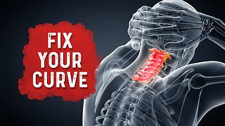 How To Fix Your Neck Posture/Curvature for Neck Pain Relief? – Dr. Berg
