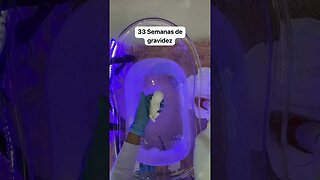 33 Semanas de gravidez