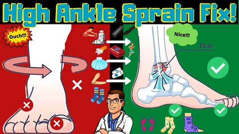 High Ankle Sprain & Syndesmotic Ankle Sprain [Test & Recovery Time]