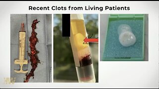 Dr. Ryan Cole - The Bleeding Truth