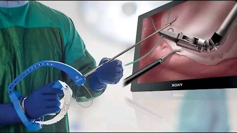 Global Laparoscopic Mesh Fixation Devices Market Research Report 2026.