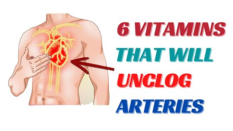 Vitamins to unclog your arteries - Top 6 Vitamins To UNCLOG Your ARTERIES
