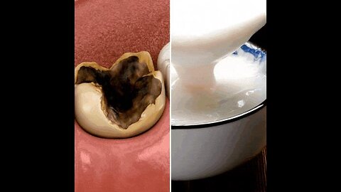 Bizarre sugar hack banishes bad breath, tooth decay & gum disease