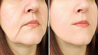 How To Tighten Loose Skin (Saggy) On Your Face