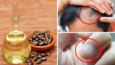 9 Amazing Things Castor Oil Can Do To Your Body