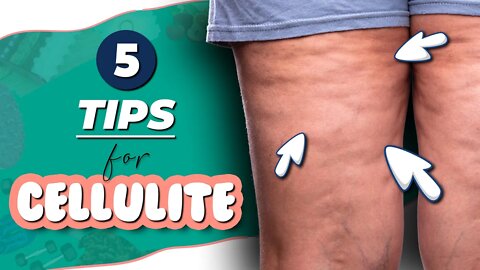 How to get RID of CELLULITE? || Simple HOME remedies