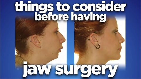 Things to consider before having jaw surgery by dr Mike Mew