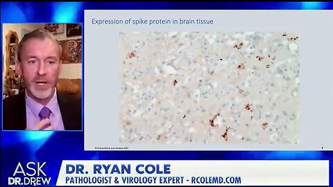 Dr. Ryan Cole - spike protein, literally causing the lymphocytes to chew a hole in the aorta