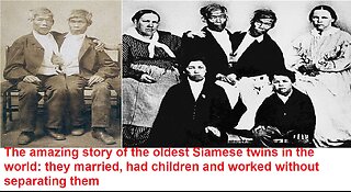 The amazing story of the oldest Siamese twins in the world: married,had children without separating