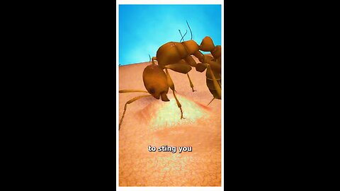 how ants bites you #trending #viral