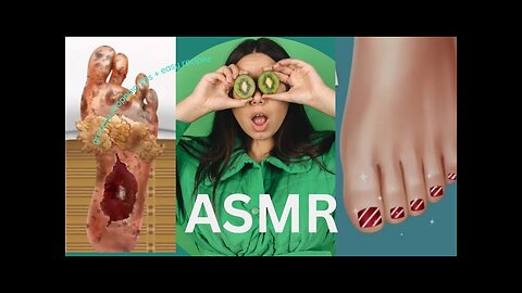 Feet Relax ASMR Satisfying foot wart Treatment | screw nail removal #asmr #animation