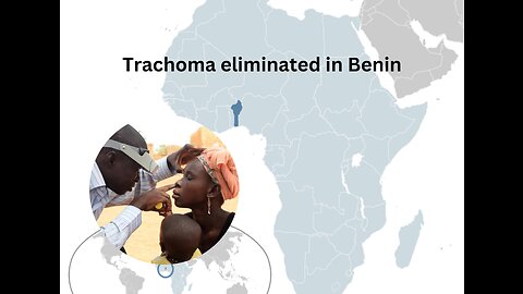 Africa: Trachoma eliminated in Benin
