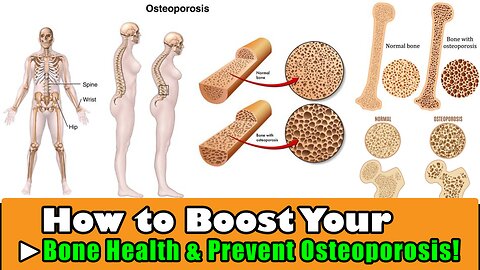 How to Boost Your Bone Health & Prevent Osteoporosis