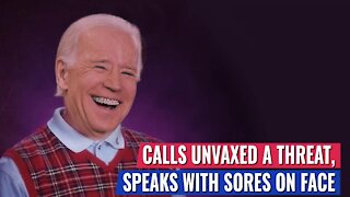 COUGHING, MASKLESS BIDEN WITH OPEN SORES ON HIS FACE CALLS UNVACCINATED A THREAT TO AMERICA’S HEALTH