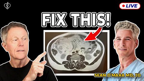 5 Things You MUST Do To Reverse Visceral FAT with Sean O'Mara MD (LIVE)