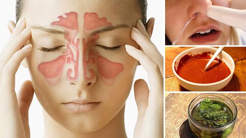 8 Ways to Clear a Stuffy Nose Naturally