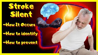 Silent stroke, how it occurs, how to identify, how to prevent!!!!!