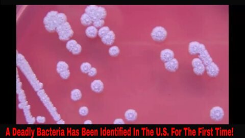 A Deadly Bacteria Has Been Identified In U.S. For The First Time After Infecting Two People!