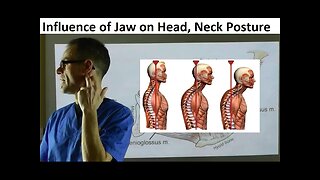 Why the Position of Jaw Influences Head, Neck & Body Posture by Dr Mike Mew