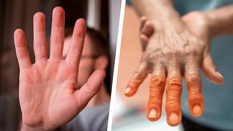 7 Things Your Hands Can Say About Your Health