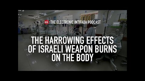 The harrowing effects of Israeli weapon burns on the body, with Dr. Tarek Loubani