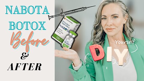OMG! The Best NABOTA BOTOX REVIEW Ever!