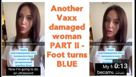 Another Vaxx damaged woman PART II | Foot turns BLUE