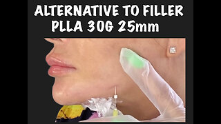 Alternative to filler PLLA screws